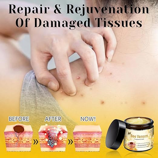 Bee Venom Cream for All Body Parts