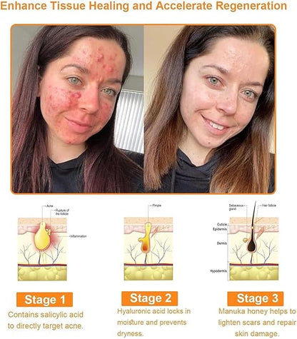 Bee Venom Cream for All Body Parts