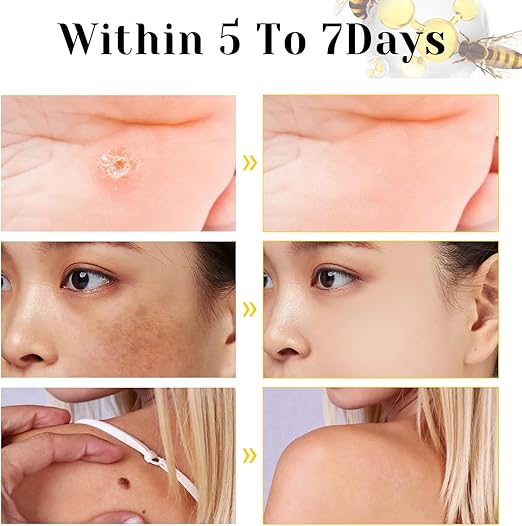 Bee Venom Cream for All Body Parts